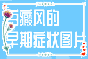 嬰兒手上有白斑是缺乏維生素嗎,常見原因(病情加重是因?yàn)槭裁?