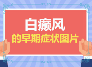 白殿病是什么原因引起-寶寶脖子淹后有白斑以后會(huì)好嗎