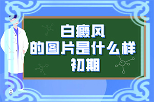 手背上有白斑是什么原因引起的,哪些緣由導(dǎo)致(有什么因素呢)