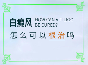 白殿斑能治好嗎[需要做哪些準備]白點癲風可以治愈嗎