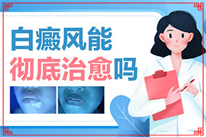 白癩風(fēng)有哪些的癥狀[得了會(huì)有什么癥狀呢]臉上長(zhǎng)白殿風(fēng)怎么辦