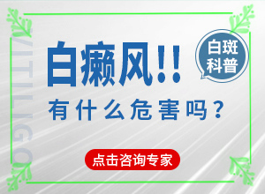 白癲風初級癥狀,具體表現(xiàn)有哪些(癥狀有哪些)