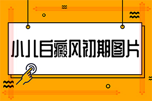 手指上長白顛瘋?cè)绾沃委焄該如何治療]哪個治療白癲好