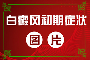 白癜風什么因素能導致-打瘦臉針臉部出現(xiàn)白斑怎么回事