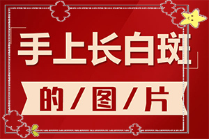 白瘋顛初期癥狀[初期有哪些癥狀]白顛風(fēng)初期圖片