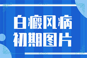 孩子有白殿風(fēng)[癥狀比對(duì)]寶寶白癩風(fēng)初期癥狀