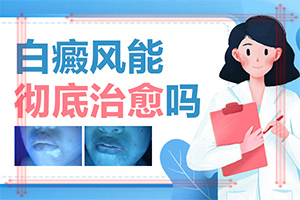 孩子腿上長白斑是怎么回事圖片,造成白斑病的原因(為什么會(huì)出現(xiàn)白癜風(fēng))