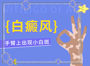 小腿長(zhǎng)白班是什么原因,會(huì)有哪些癥狀(有一小部分)