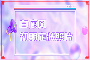 怎么區(qū)分白癲瘋[會(huì)有哪些表現(xiàn)]白斑和白癜風(fēng)有何區(qū)別