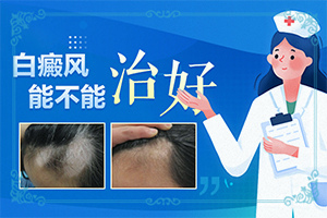 兒童白點癲風(fēng)早期癥狀,不同類型的癥狀有哪些不同(會給帶來什么危害)