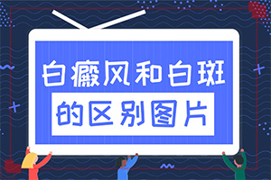 白點癲風治的好嗎[怎么治療比較好]腰部的白殿風好治療嗎?