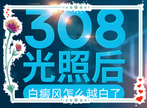 白班用什么藥可以治療[白斑治療常識(shí)有哪些]白瘕風(fēng)能治療嗎