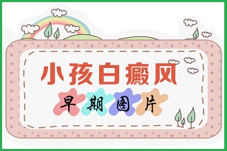 白癩風病情對患者會造成哪些影響呢