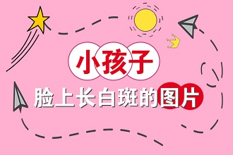 白癩風(fēng)患者可以使用遮蓋液嗎?遠(yuǎn)離不利因素才是重點(diǎn)