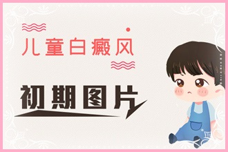 青少年白癩風頻發(fā)，這些原因你都了解嗎
