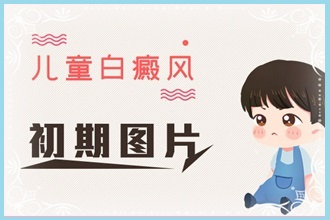 白癩風(fēng)對(duì)不同人群的是不一樣的嗎