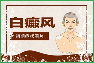 白癩風(fēng)遮蓋液去哪家買(mǎi)好，什么牌子的比較好用呢