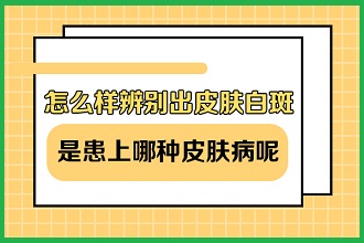 白癩風(fēng)患者運(yùn)動(dòng)改善體質(zhì)，同時(shí)這些事項(xiàng)注意不能缺少