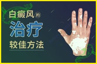 白顛風(fēng)怎么治療好的快-檢查病因、制定方法、防護三步走