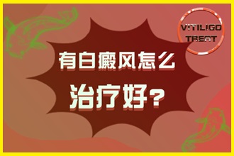 白點風(fēng)怎么治療好的快-有效方法(藥物還是光療)