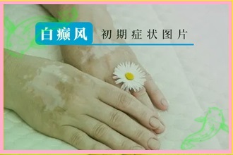 白白課堂|孕婦白點癲風(fēng)是什么原因引起的-科學(xué)檢測便利病情醫(yī)治