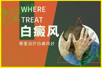 白癲風(fēng)的早期癥狀圖片避免擴散，這些措施要一一執(zhí)行