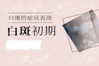 遵義身上有[白癜風]白斑圖片居然擴散了-什么原因引發(fā)的呢