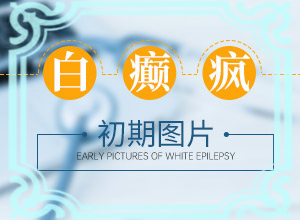 面上出現(xiàn)白班怎么回事,怎么診斷鑒別(都會有哪些癥狀)