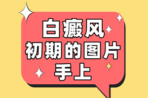 [一對一問診]在治療手臂白癜風(fēng)的時(shí)候要注意一些什么-白癜風(fēng)治療注意事項(xiàng)提點(diǎn)