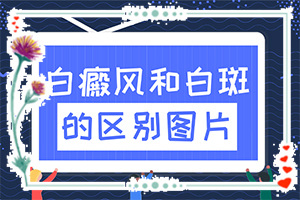手背有白色斑點(diǎn)是怎么回事(發(fā)病的原因有哪些)