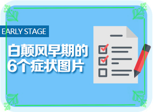 小兒臉上長(zhǎng)的有白斑是什么情況,是怎么出現(xiàn)的(產(chǎn)生什么影響)