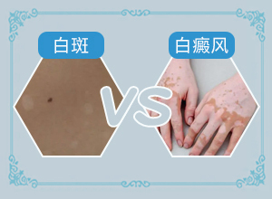 白癲風(fēng)會有什么癥狀[都有哪些癥狀]身體出現(xiàn)白班怎么辦