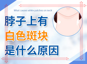 臉上白斑是什么原因，如何解決,什么原因會誘導(dǎo)白斑(常見原因)