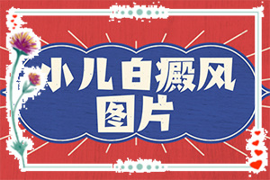 嘴角旁長白班,癥狀表現(xiàn)特點(diǎn)是(什么樣)