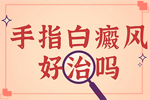 如何區(qū)別白癲瘋[好發(fā)部位有哪些]白殿瘋早期癥狀