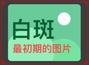 白斑是什么原因引起-哪些誘因會(huì)導(dǎo)致白癜風(fēng)