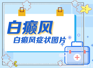 兒童白顛風(fēng)早期癥狀,剛患上了都有哪些癥狀表現(xiàn)呢(診斷依據(jù))