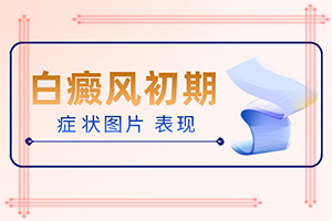 白癩風能治嗎[治療咋樣呢]小孩白點癲風能嗎?