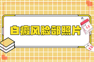 小寶寶脖子上有白斑點是什么原因，怎么治療（為何不易治）
