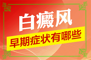 白癩風有哪些的癥狀[發(fā)病的時候有什么癥狀]輕微白癩風圖片