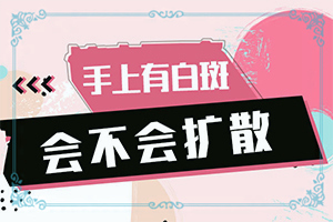 白點癲風(fēng)如何治療了[哪些問題能治]兒童白癩癜風(fēng)能治好嗎