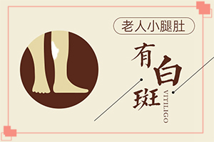怎樣治療白癲瘋,如何治療好(對白癜風的治療有幫助嗎)