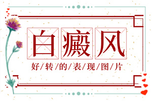背上有白癲是怎么回事,容易被忽視癥狀有哪些(表現(xiàn)癥狀有哪些)