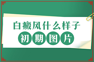 長(zhǎng)白癩風(fēng)有什么癥狀,不同時(shí)期的癥狀有哪些呢(不同時(shí)期發(fā)病時(shí)病癥)