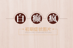 [網(wǎng)友關(guān)心]早期白癜風(fēng)的發(fā)病表現(xiàn)有哪些-白癜風(fēng)早期癥狀圖片-白癜風(fēng)特點有哪些