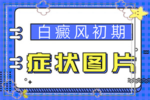 輕度白癩風(fēng)圖片[不同時期發(fā)病時病癥]腿上白班是怎樣引起的