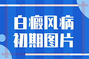 兩只腳背最高處有白斑塊咋回事,造成白斑病的原因(幾大病因是什么)