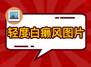 身上出白斑的原因-發(fā)病的因素是