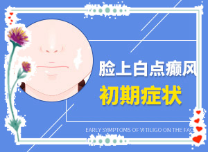 白顛瘋癥怎么治療最好[怎么治療比較合適]兒童白癩癜風能治好嗎