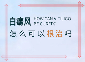 小孩臉上有淡白斑缺什么維生素,常見原因(因為什么患上)